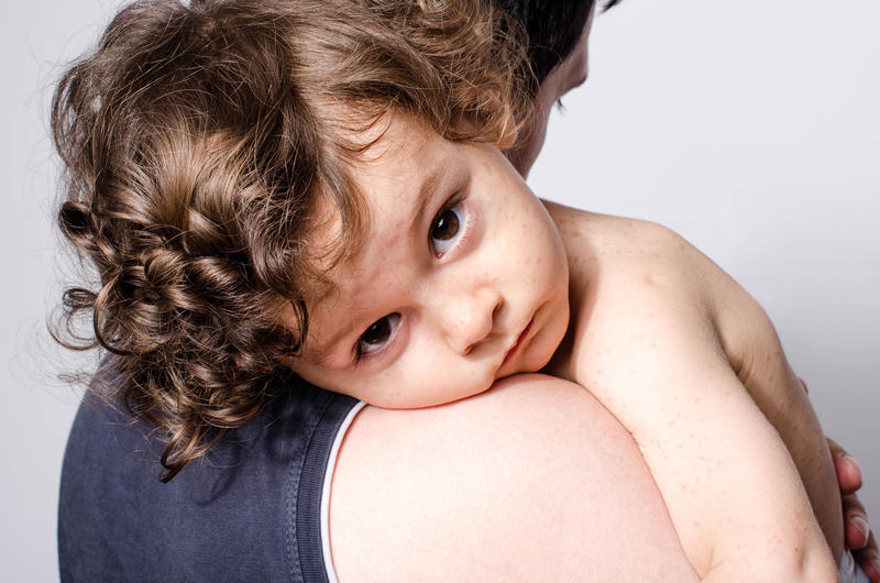Boala care este de zece ori mai contagioasă pentru copii decât COVID-19: Europe s-a confruntat cu cele mai mari îmbolnăviri din ultimele 25 de ani