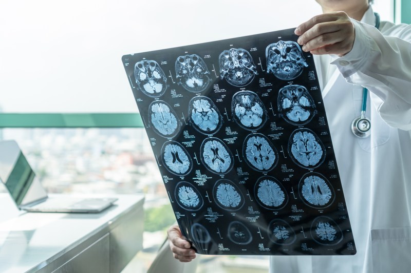 Riscurile meningitei și motivația denumirii „boala contra timp”. Deși există vaccin, în România acesta nu este compensat. Cum stau lucrurile în alte țări?
