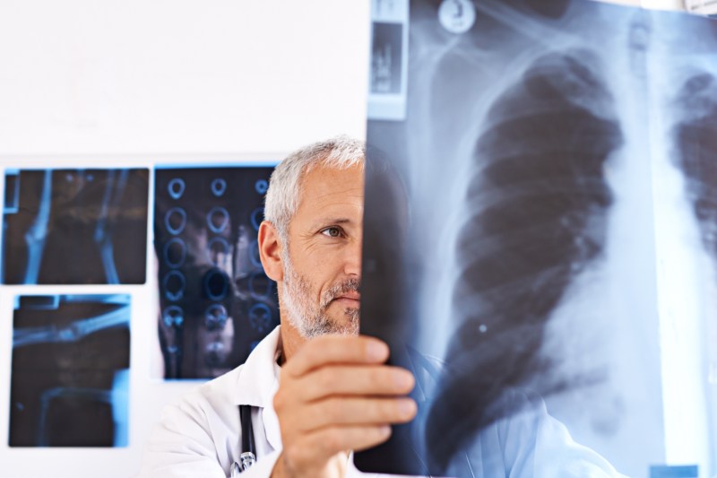 Anunțul Ministrului Sănătății privind prima strategie națională de screening: „Include mai mult decât screeningul pentru cancer”