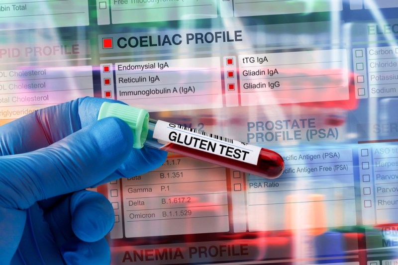 Detectarea predispoziției genetice pentru boala celiacă: Recomandări pentru copii